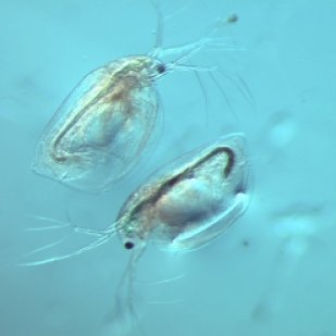 Zooplankton from a study pond